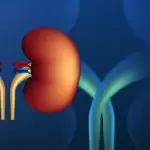 kidney stones treatment